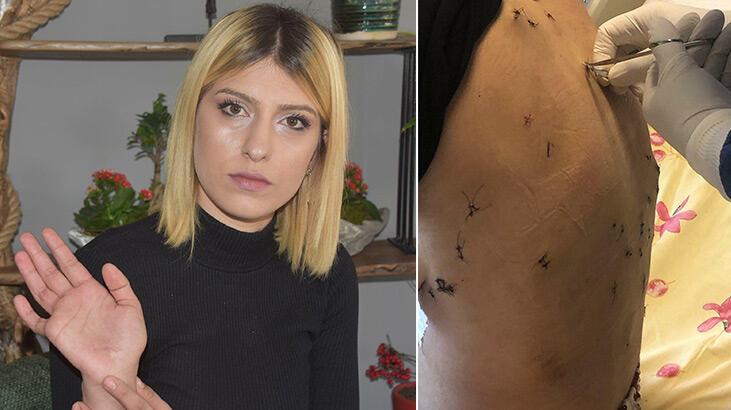 Eşi 38 yerinden bıçaklamıştı! Verilen hapis cezası onandı