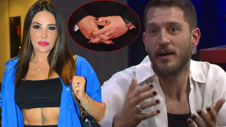 Esra Balamir'den 'oje' tepkisi: Uraz'a ne oluyor?